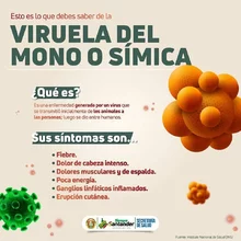 Esto es lo que debes saber de la viruela del Mono o Símica